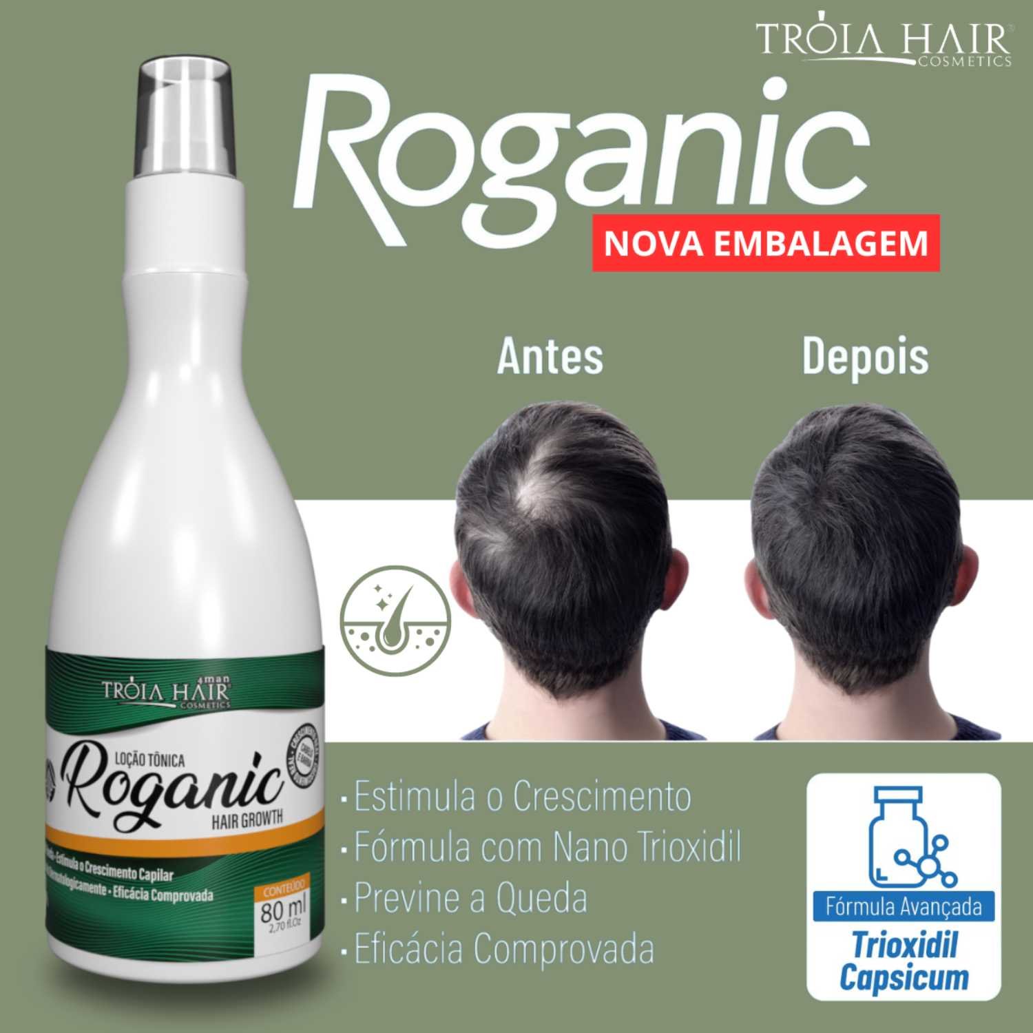 Spray Para Crescer Cabelo Tônico Roganic Hair Grownth Troia 80ml - Imagem 2