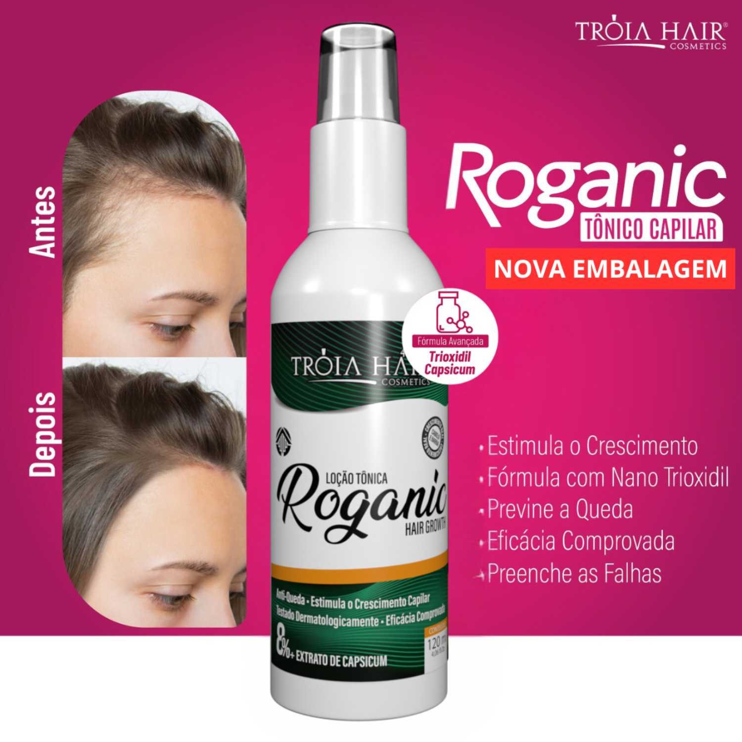 Spray Para Crescer Cabelo Tônico Roganic Hair Grownth Troia 120ml - Imagem 2