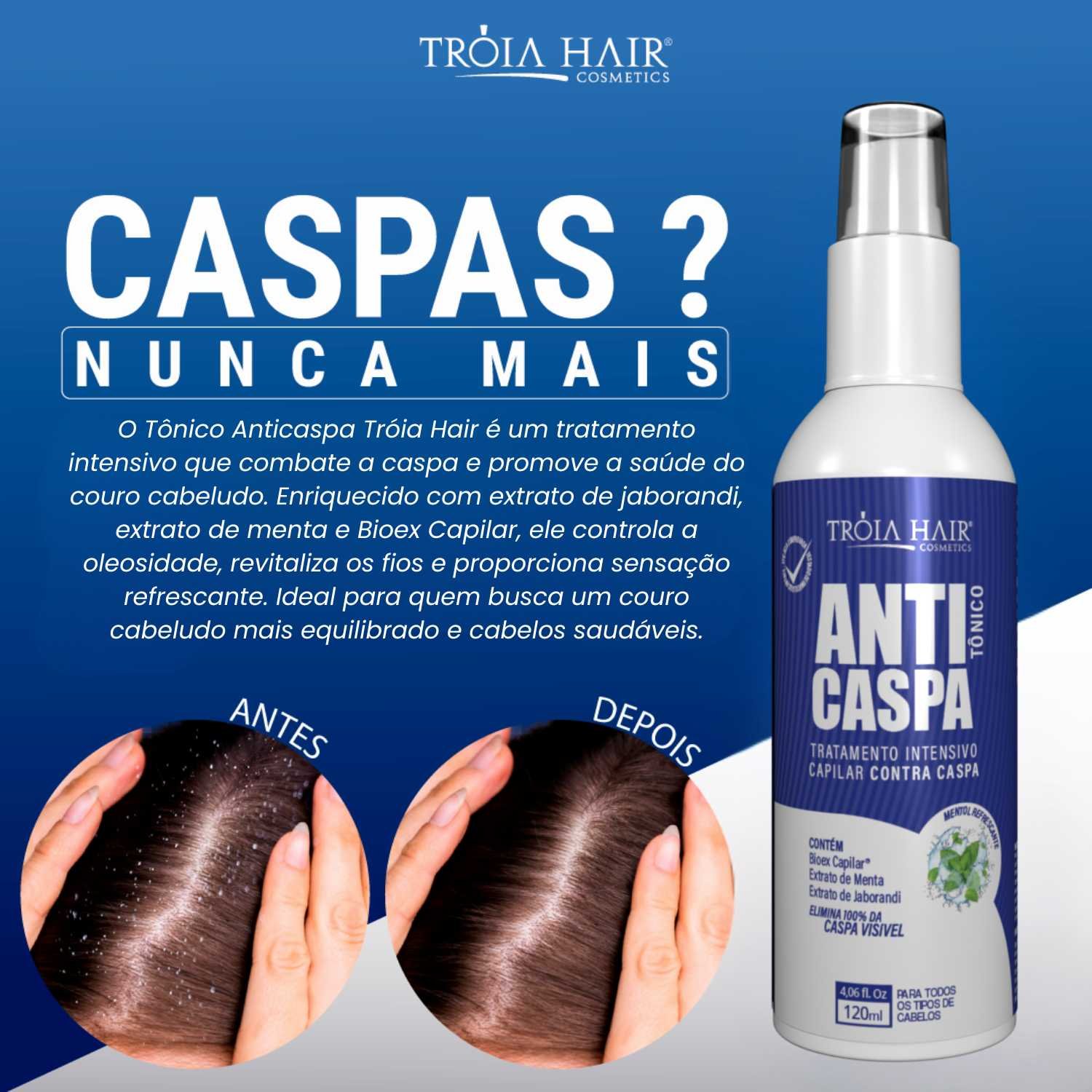 Tônico Anticaspa 120ml Tratamento Intensivo Para Caspa Tróia Hair - Imagem 3