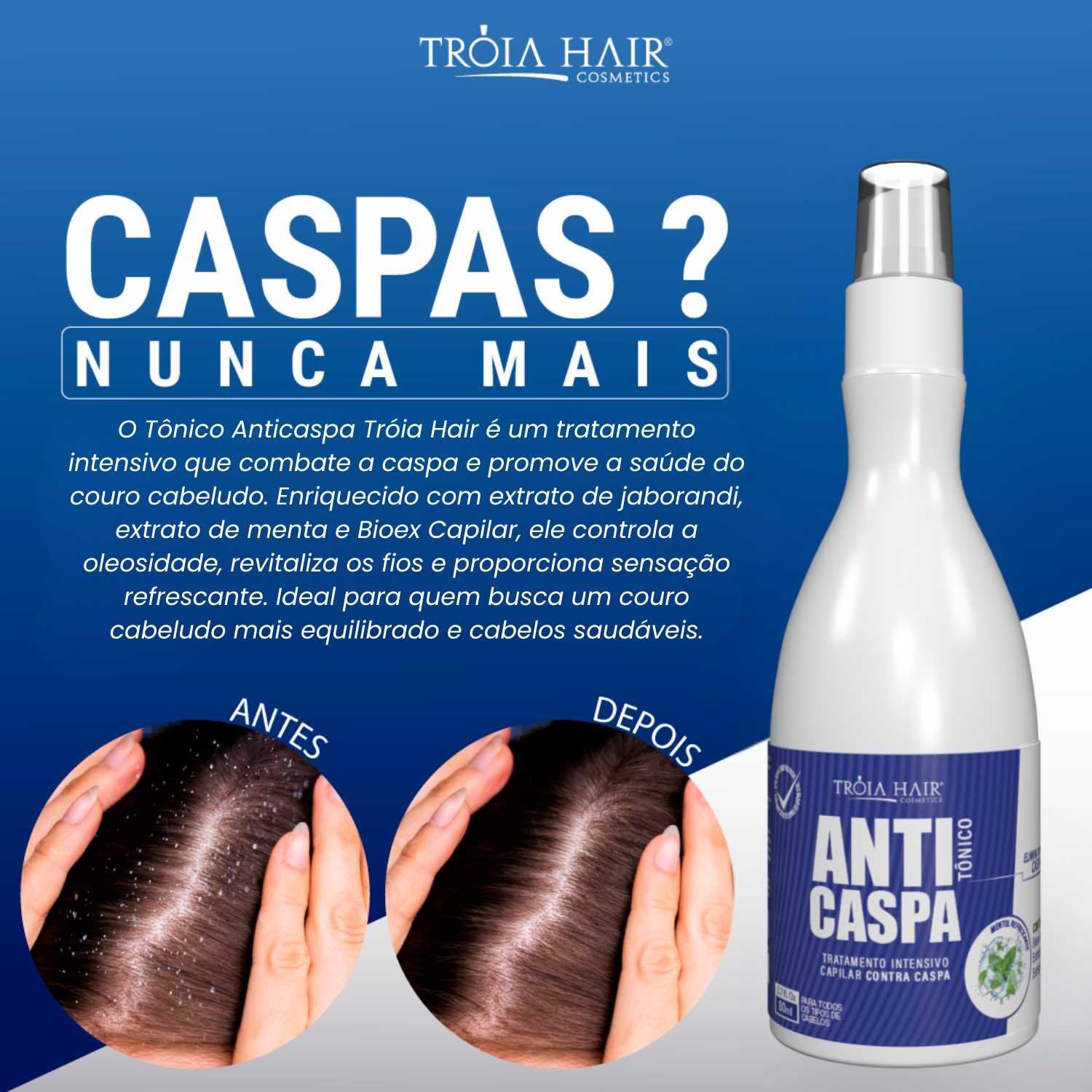 Tônico Anticaspa 80ml Tratamento Intensivo Para Caspa Tróia Hair - Imagem 6